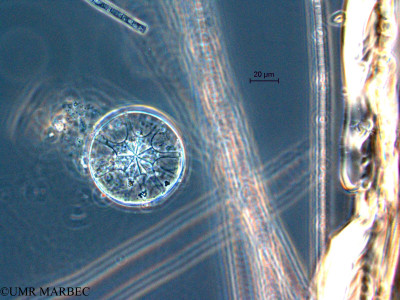 phyto/Scattered_Islands/all/COMMA April 2011/Asterolampra sp (2)(copy)_thumb.jpg